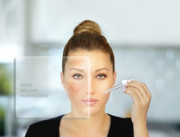 4% Hydroquinone Cream (Melalite): Dermatologist-Supported Treatment for Melasma and Hyperpigmentation Hydroquinone Cream